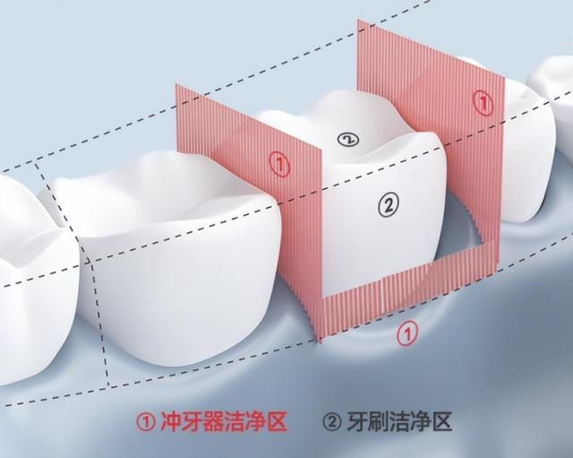 拉卡拉POS机免费申请：爆肝主流冲牙器测评PK真实数据分享！松下丨扉乐丨洁碧等